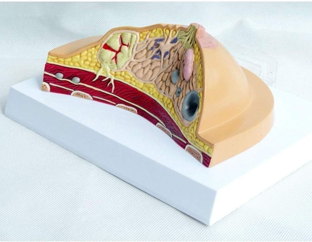 TIST Anatomical Model of Female Breast Contour Structure Anatomical Diseases Cancer Pathological Breast Model Pathological Breast Cross Sectional Anatomical Model