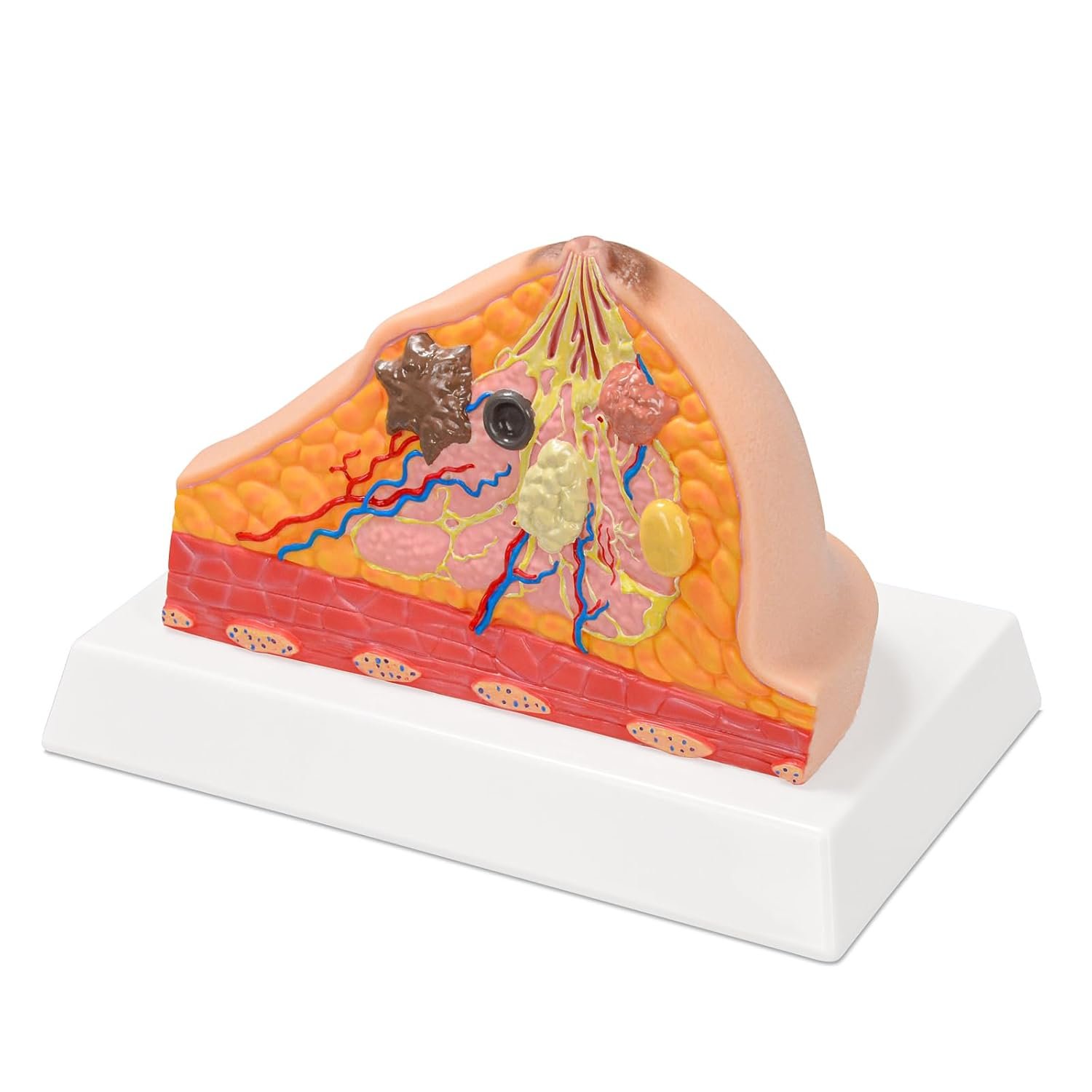 Ultrassist Breast Anatomy Model with Pathological Features, BreastCross Section Educational Tool for Medical Teaching, Nursing Training, Patient Communication, Self-Examination Awareness