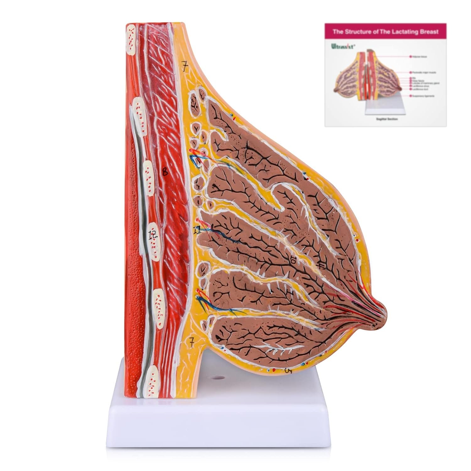 Ultrassist Lactating Breast Sagittal Section Model, Breast Anatomy Model Include Study Card, for Breast Surgeon Gift