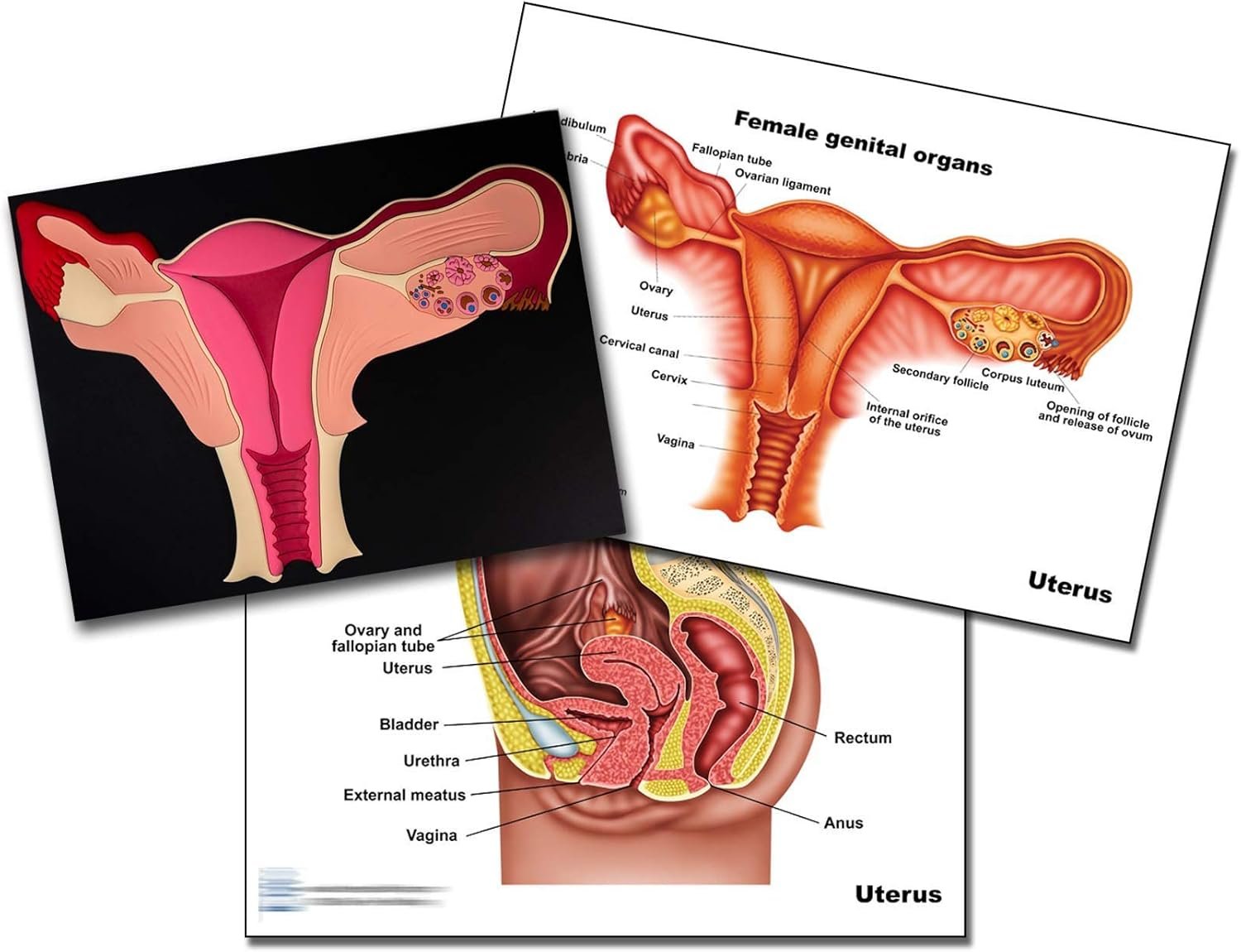 Blue Tree Publishing Woman,s health (Uterus model)